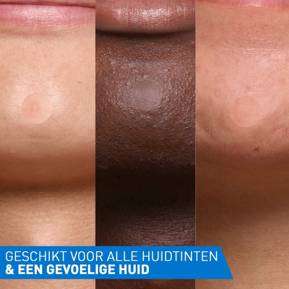 Drie close-ups van kinnen met CeraVe Anti-Puistjes Patch op verschillende huidtinten. Tekst in beeld: “Geschikt voor alle huidtinten & een gevoelige huid.”