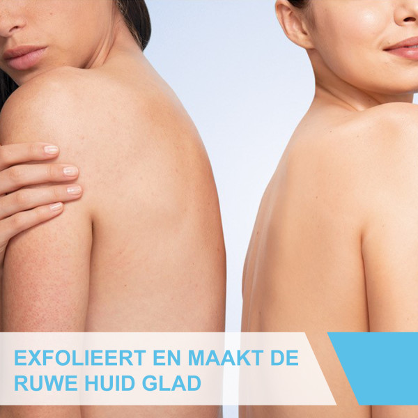 Cerave Anti-Ruwe Huid Crème