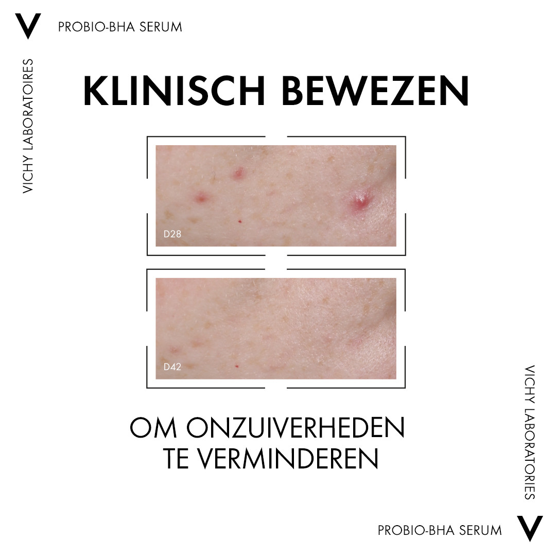 Vichy Normaderm Pro-Bio Bha Serum