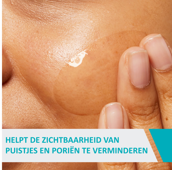 Cerave Acne Control Gel