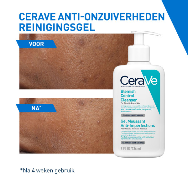 Cerave Blemish Control Cleanser