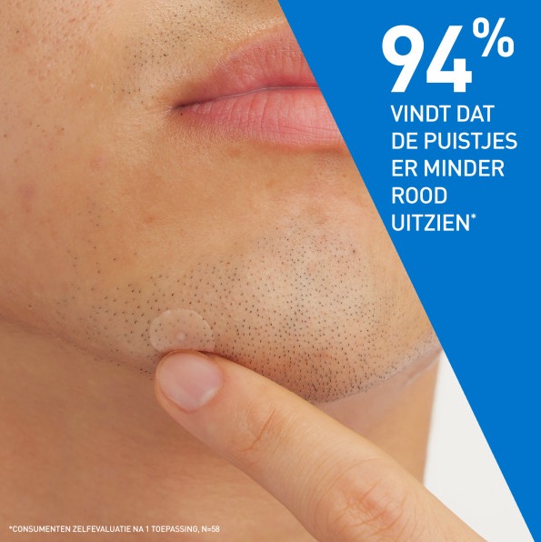 Cerave Anti-Puistjes Patches