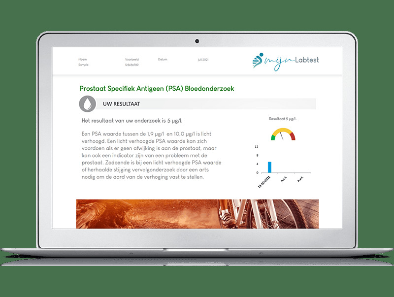 Mijnlabtest Psa Prostaat Bloedtest